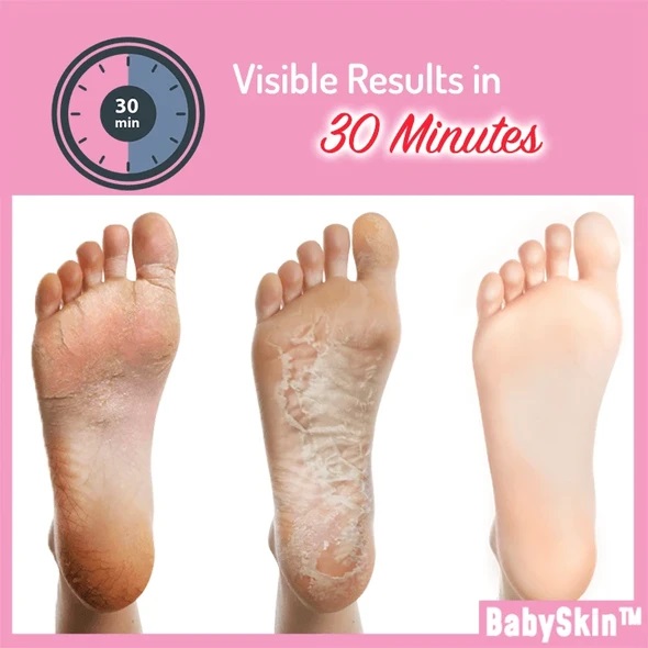 Baby Foot Exfoliation Peeling Mask