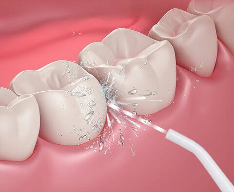 Cordless Ultra Water Flosser & Oral Irrigator