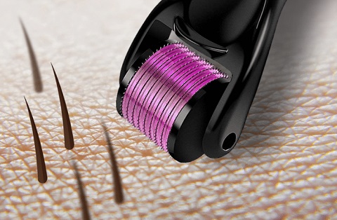 Derma Roller For Hair And Beard Growth - Work For Hair Loss