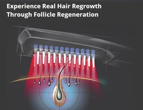 Infrared Laser Comb - Scalp Massager For Hair Growth