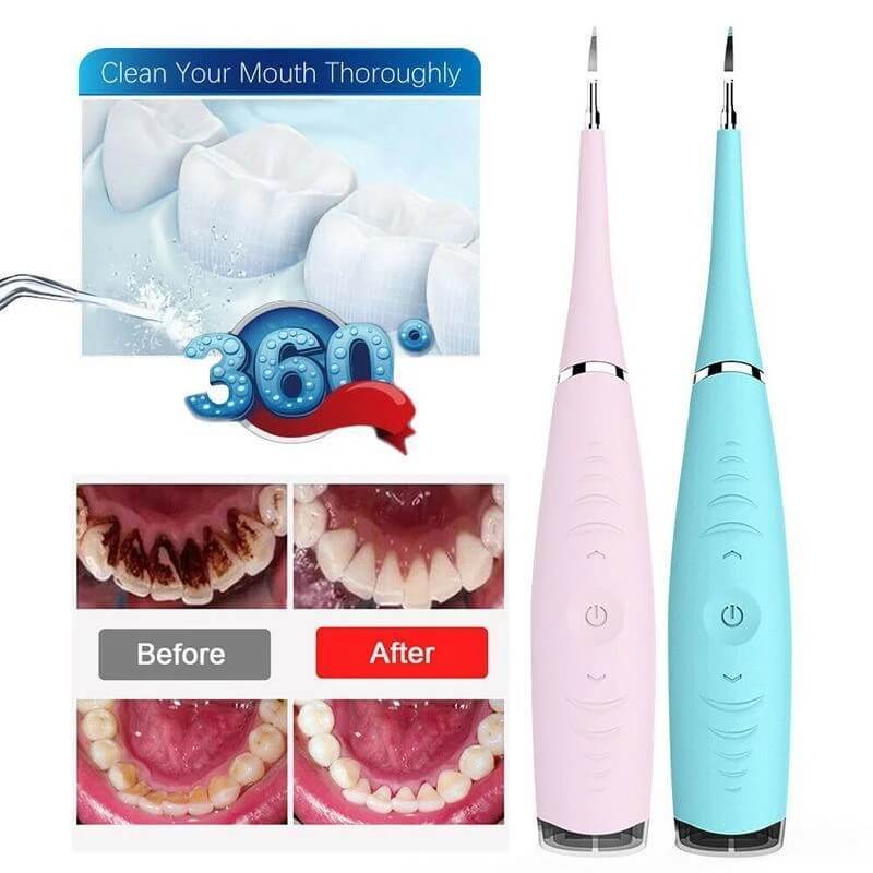 Ultrasonic Tooth Cleaner - Dental Scaler