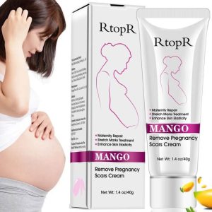 Stretch Mark Removal Cream