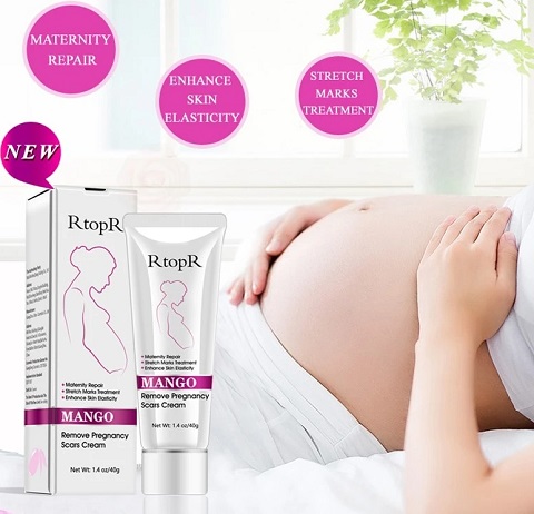 Stretch Mark Removal Cream