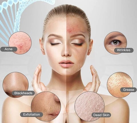 Ultrasonic Facial Scrubber - Electric Skin Spatula