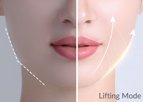 Ultrasonic Facial Scrubber - Electric Skin Spatula