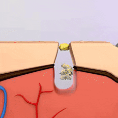 Ultrasonic Facial Scrubber - Electric Skin Spatula