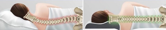 Ideal Pillow For Side Sleepers - Cervical Support For Neck Pain Stiffness & Strain Problems