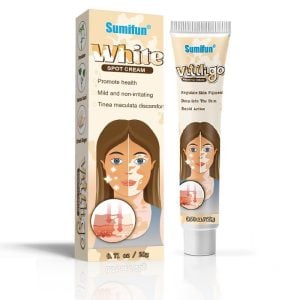 Vitiligo Disease Treatment - White Color Spot & Patches On Skin Therapy