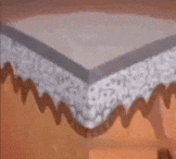 Vitiligo Disease Treatment - White Color Spot & Patches On Skin Therapy