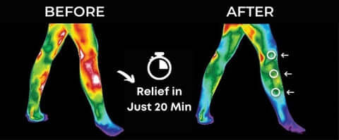 Meniscus Tear & Knee Joint Pain Relief Treatment For Torn Swollen Painful Injury Damage Strain