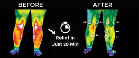 Meniscus Tear & Knee Joint Pain Relief Treatment For Torn Swollen Painful Injury Damage Strain