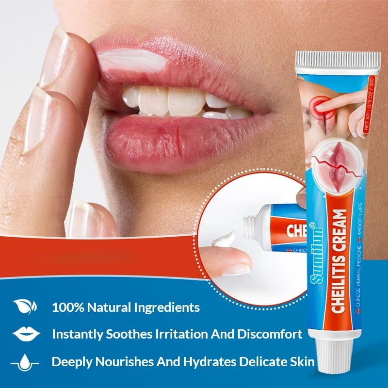 Angular Cheilitis & Perleche Treatment - Chapped Cracked Lip Corners & Cold Sore Of Mouth