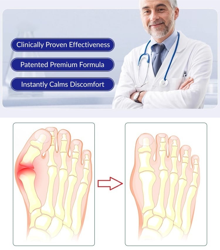Bunion Pain Relief Cream - Bunions On Feet Treatment At Home