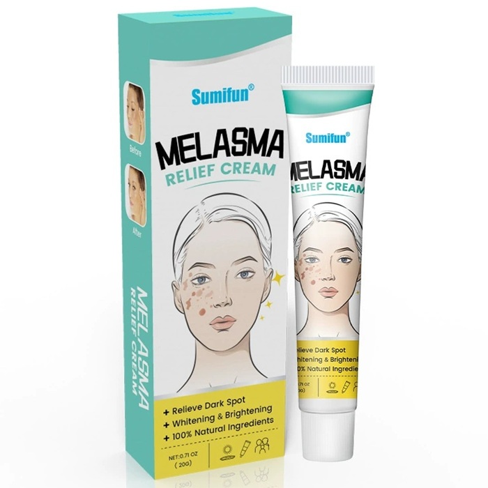 melasma-on-face-skin-hyperpigmentation-treatment-remove-dark-spots-patches-3 Melasma On Face & Skin Hyperpigmentation Treatment - Remove Dark Spots & Patches