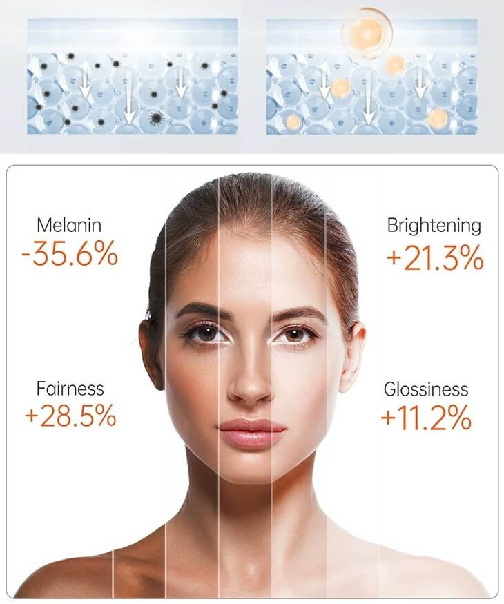 Melasma On Face & Skin Hyperpigmentation Treatment - Remove Dark Spots & Patches