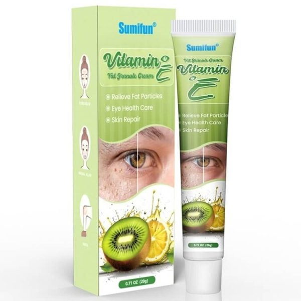 Milia Removal Treatment On Face Under Around Eyes & Milium Cysts On Eyelid Lips At Home