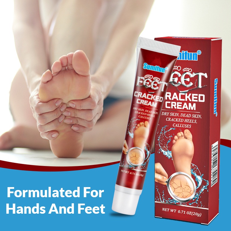 Cracked Heels Treatment Cream Extremely Dry Feet Remedy - Rescue Foot Moisturizer