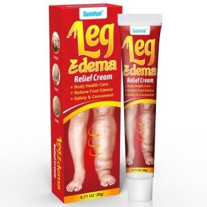 Edema & Feet Swelling Treatment - Water Retention In Swollen Legs & Puffy Ankles