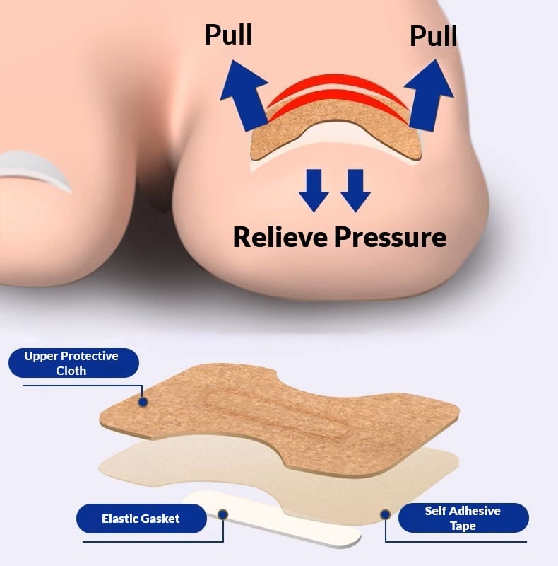 Paronychia Treatment & Fix Infected Ingrown Toenail - Self-Care​ Treatment At Home