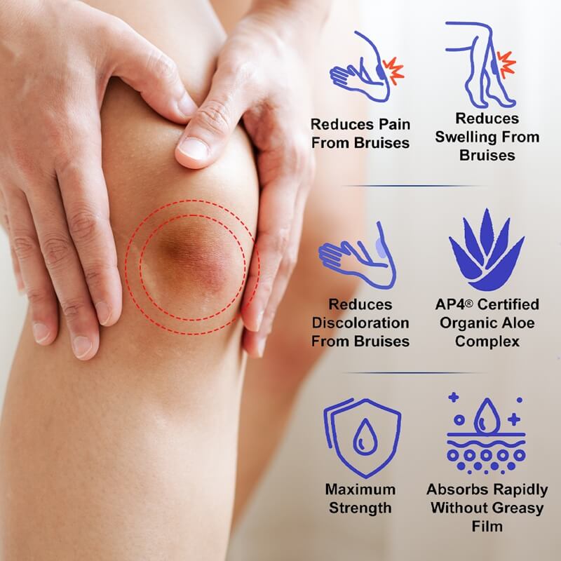 Deep Bruises Ointment & Hematoma Relief Home Treatment Cream For Bruising Bone & Bruised Rib