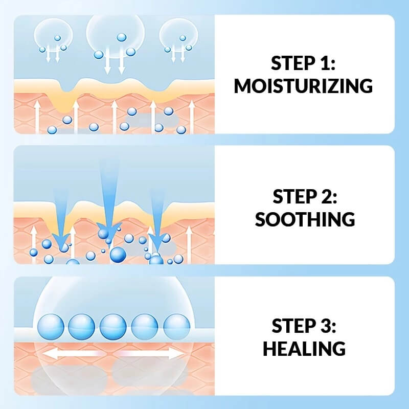 Heel Cracked Treatment - Best Foot Cream For Extremely Dry Feet & Painful Cracked Heels Remedy