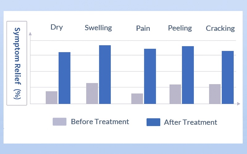 Heel Cracked Treatment - Best Foot Cream For Extremely Dry Feet & Painful Cracked Heels Remedy