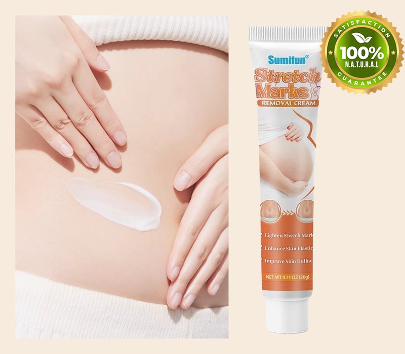 Stretch Mark Removal Treatment Cream - Topical Belly Lotion Moisturizer Best For Pregnancy