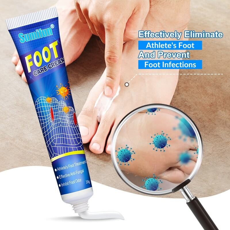 Athlete's Foot Fungal Feet Treatment - Cure For Tinea Pedis Fungus Infection