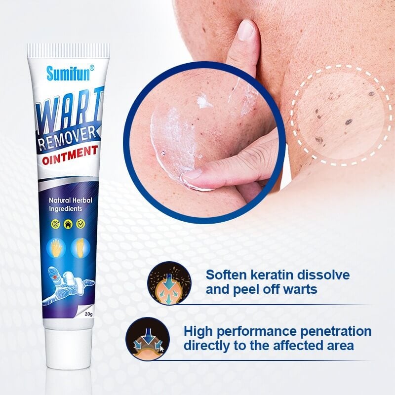Plantar Wart Removal Natural Treatment On Feet Hands Finger Toe At Home