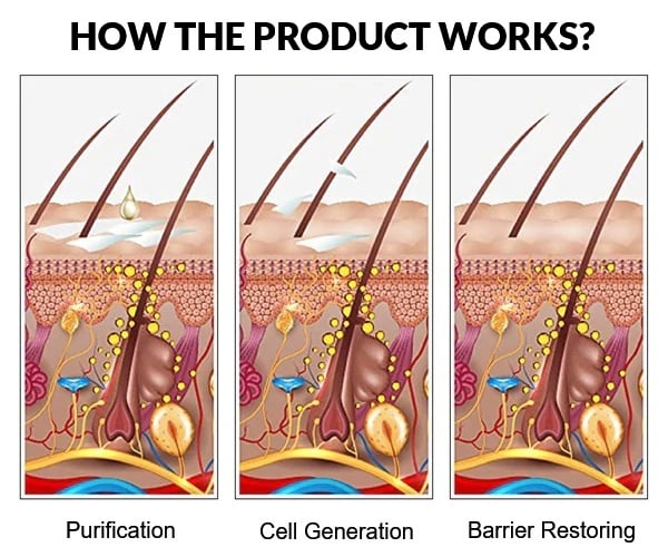 Seborrheic Dermatitis Treatment For Eczema On Head Scalp Dandruff And Face