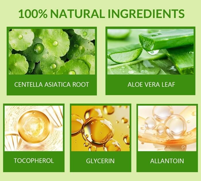 Eczema Rash​ Treatment​ Cream​ For Dyshidrotic & Nummular Eczema​