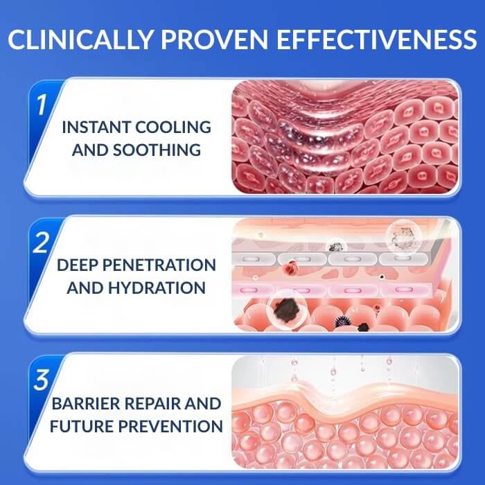 Eczema Rash​ Treatment​ Cream​ For Dyshidrotic & Nummular Eczema​