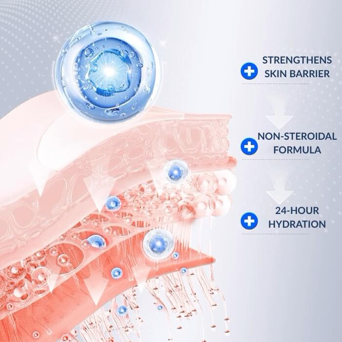 Eczema Rash​ Treatment​ Cream​ For Dyshidrotic & Nummular Eczema​