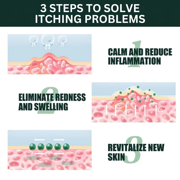 Plaque Psoriasis Rash Treatment On Scalp Face Hand Feet - Anti Itch & Scratch Skin Cream