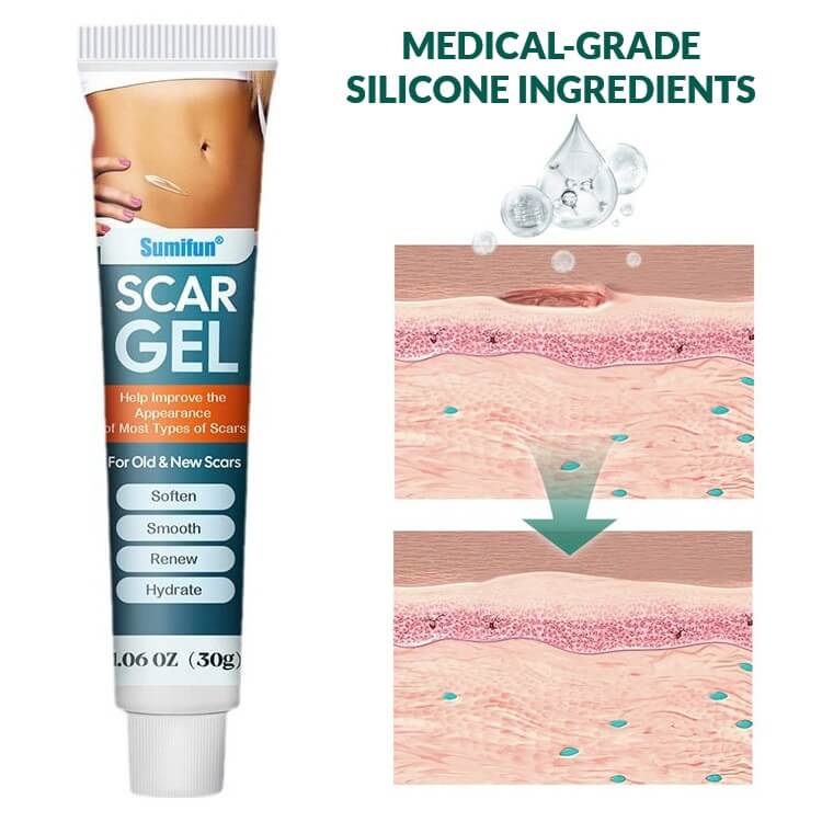 Scar & Keloid Removal Healing Treatment Cream At Home