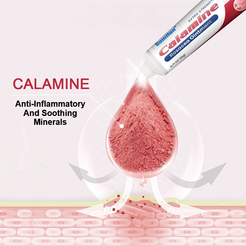 Rosacea Redness On Face Therapy - Calamine Lotion Self Care Treatment For Facial Flushing