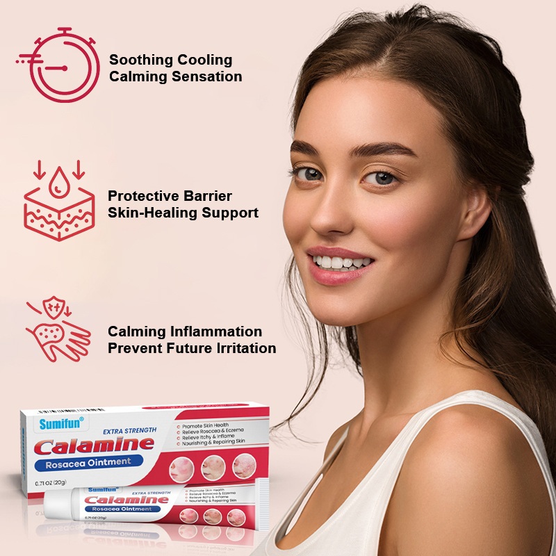 Rosacea Redness On Face Therapy - Calamine Lotion Self Care Treatment For Facial Flushing