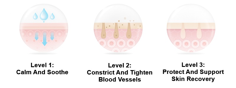 Rosacea Redness On Face Therapy - Calamine Lotion Self Care Treatment For Facial Flushing